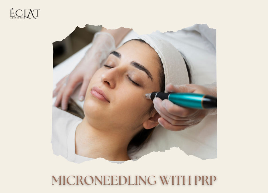 Pre Wedding Microneedling With PRP Pre Wedding Microneedling With PRP