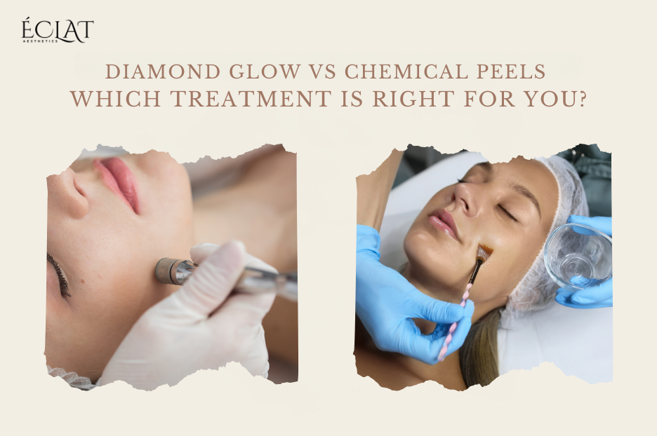 Diamond Glow vs Chemical Peels
