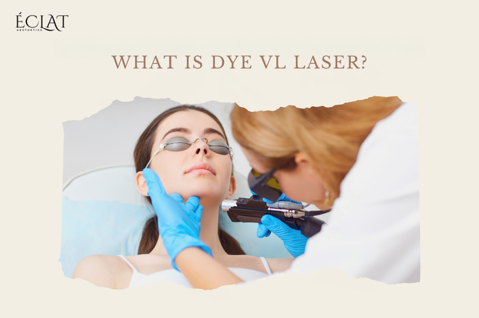 How Dye VL Laser Erases Pigmentation Safely Say Goodbye to Sunspots 2 What is Dye VL Laser?