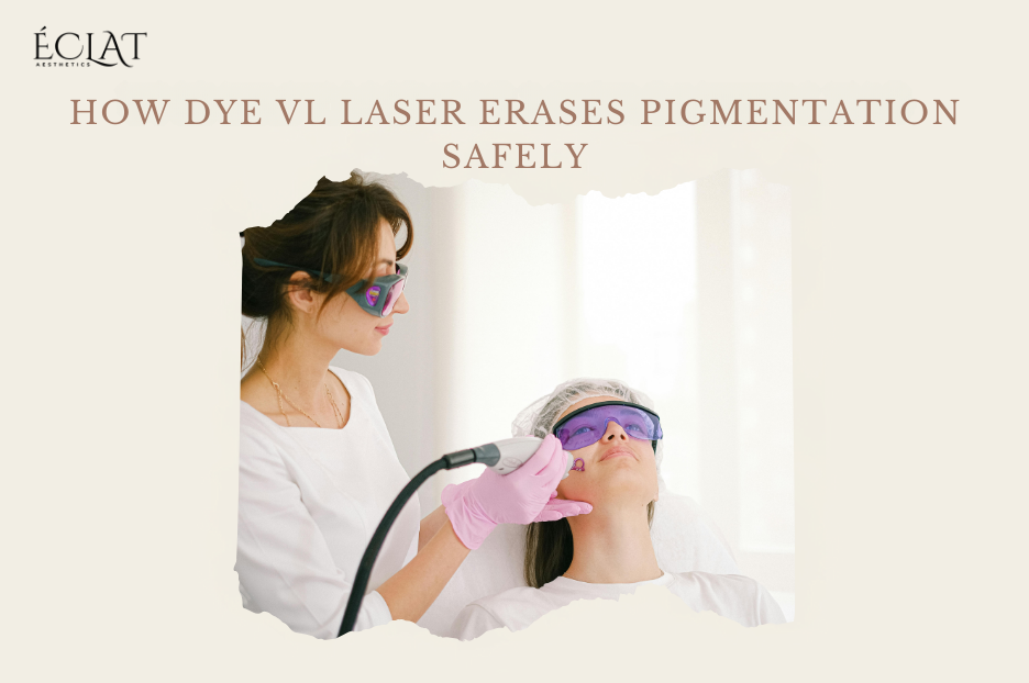How Dye VL Laser Erases Pigmentation Safely | Say Goodbye to Sunspots