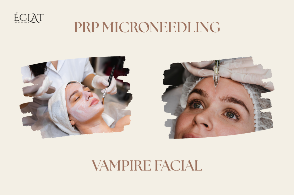 PRP Microneedling | Vampire Facial That Actually Works on Acne Scar