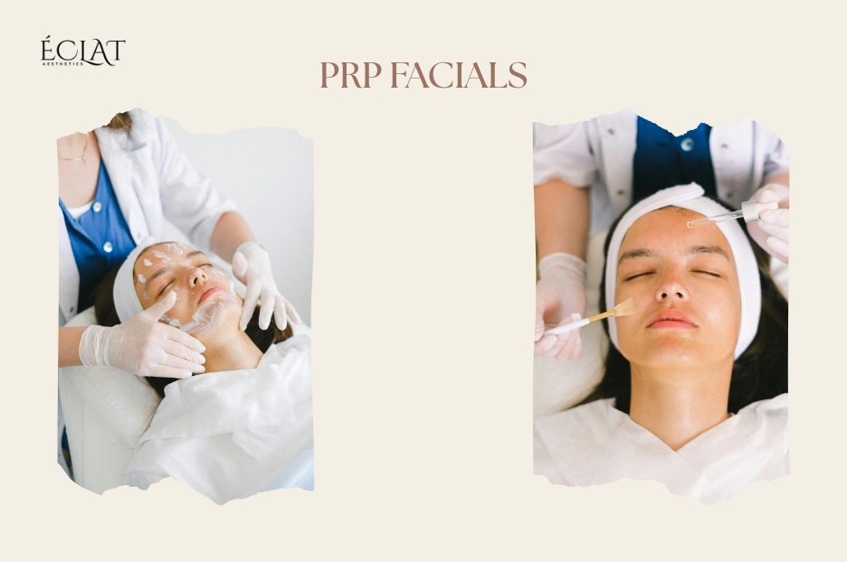PRP Microneedling Vampire Facial That Actually Works on Acne Scar 3 PRP Microneedling | Vampire Facial That Actually Works on Acne Scar