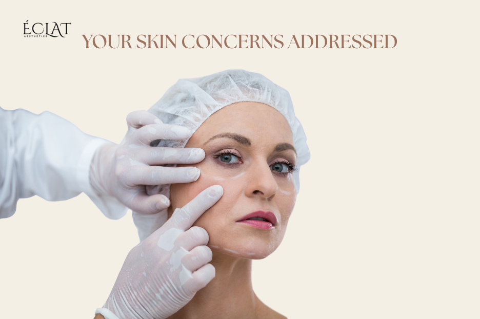 Top Benefits of ClearLift - Reverse Aging Without Surgery 3 Top Benefits of ClearLift - Reverse Aging Without Surgery