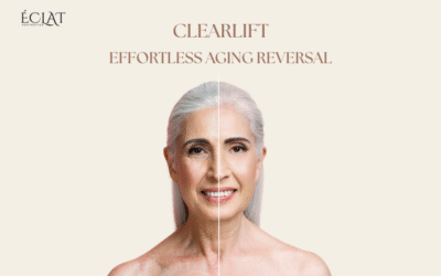 Top 7 Benefits of ClearLift – Reverse Aging Without Surgery