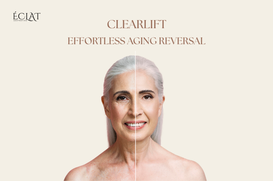 Top Benefits of ClearLift - Reverse Aging Without Surgery