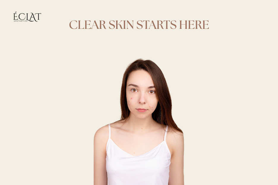 UV Light Therapy Dermatologists' Secret Weapon for Psoriasis & Acne Treatment 2 UV Light Therapy | Dermatologists' Secret Weapon for Psoriasis & Acne Treatment