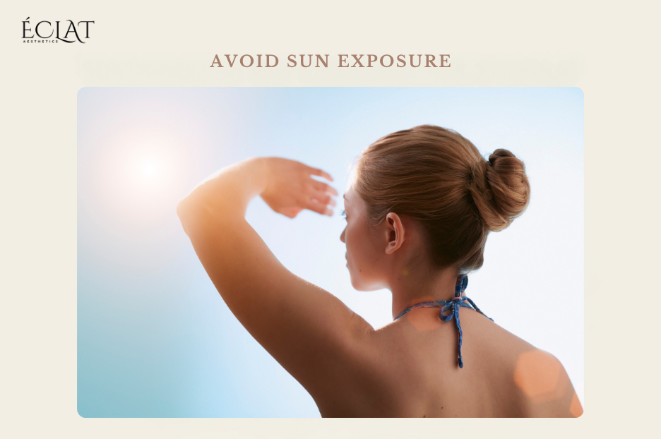 Avoid Sun Exposure Avoid Sun