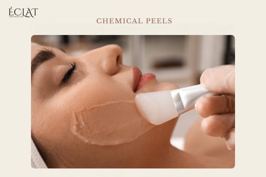 Chemical Peels Chemical Peels
