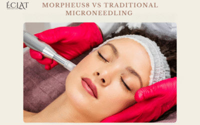 Morpheus8 vs Traditional Microneedling