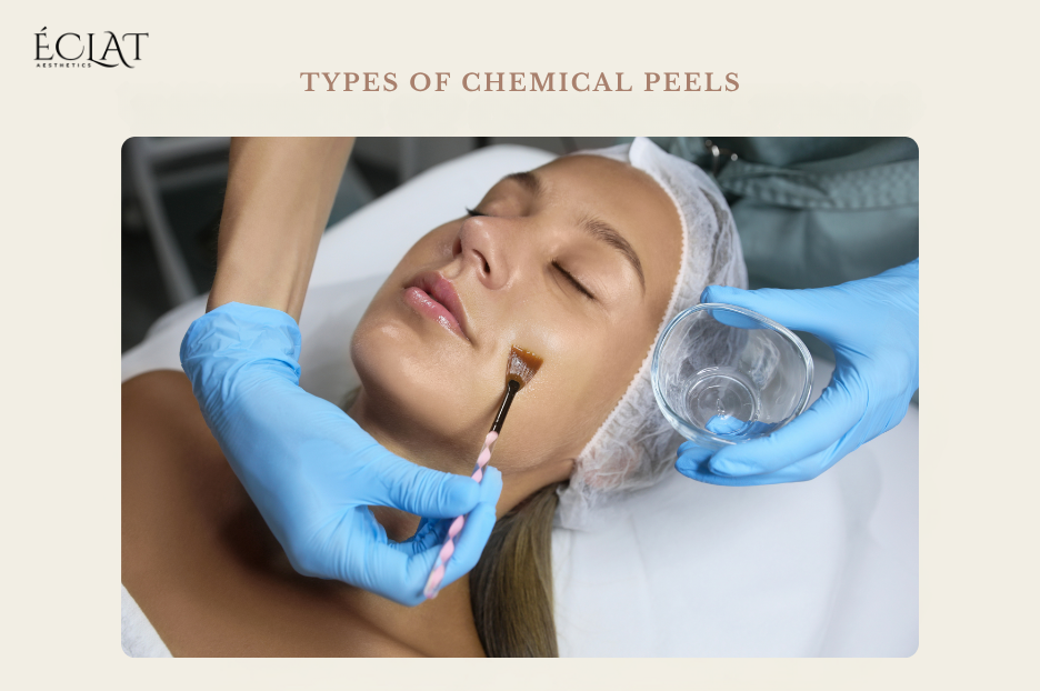 Types of Chemical Peels Types of Chemical Peels