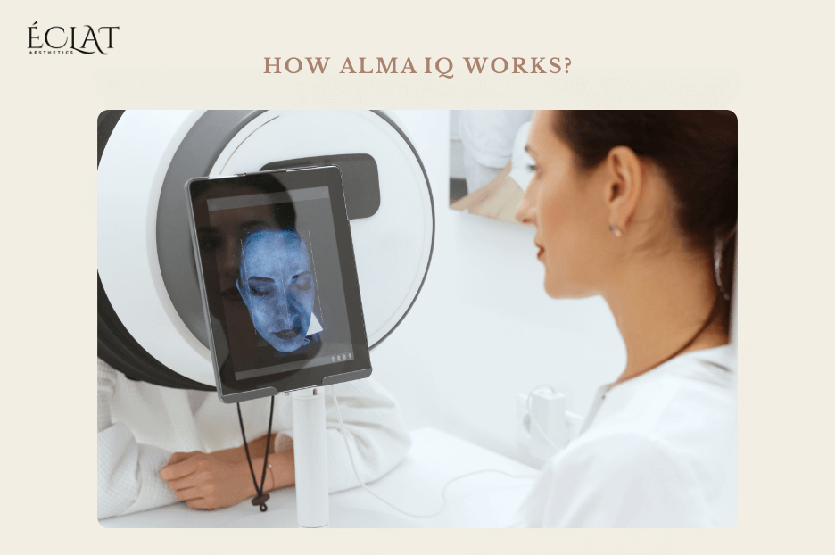 ALMA IQ ALMA IQ