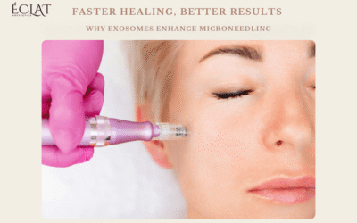 Faster Healing, Better Results | Why Exosomes Enhance Microneedling