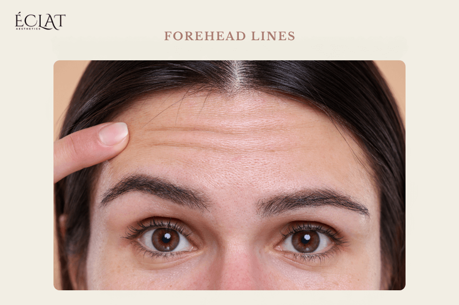 forheadlines forheadlines