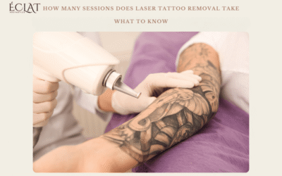 Homepage 30 How Many Sessions Does Laser Tattoo Removal Take? What to Know