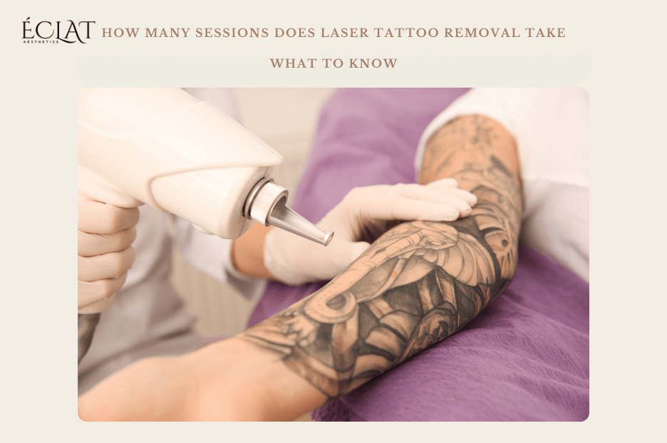 How Many Sessions Does Laser Tattoo Removal Take? What to Know