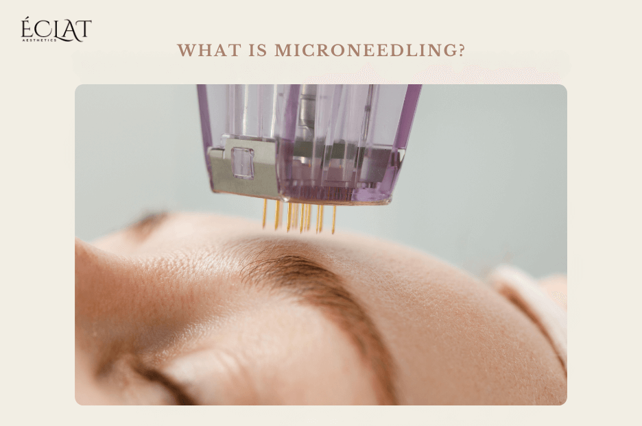 micro nedding (2) micro nedding 2