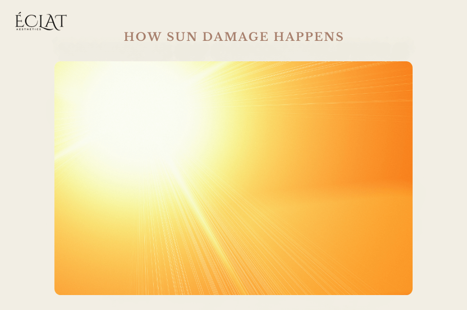 How Sun Damage Happens How Sun Damage Happens