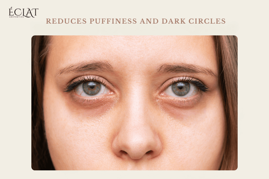 Reduces Puffiness and Dark Circles