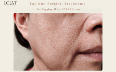 Top Non-Surgical Treatments for Sagging Skin | 2025 Edition