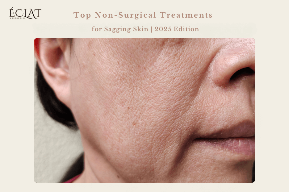 Top Non-Surgical Treatments for Sagging Skin | 2025 Edition