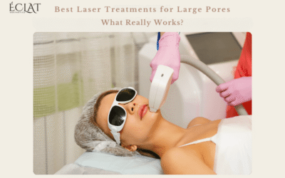 Best Laser Treatments for Large Pores on Fac | What Really Works?