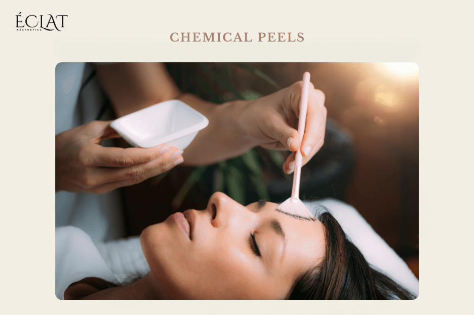Med spa fall treatments Chemical Peels