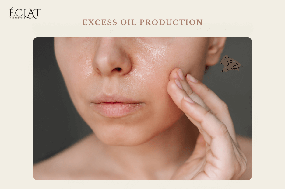 Excess oil production