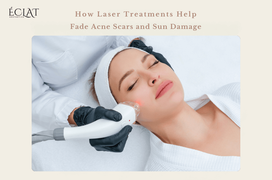 laser treatment for acne scars