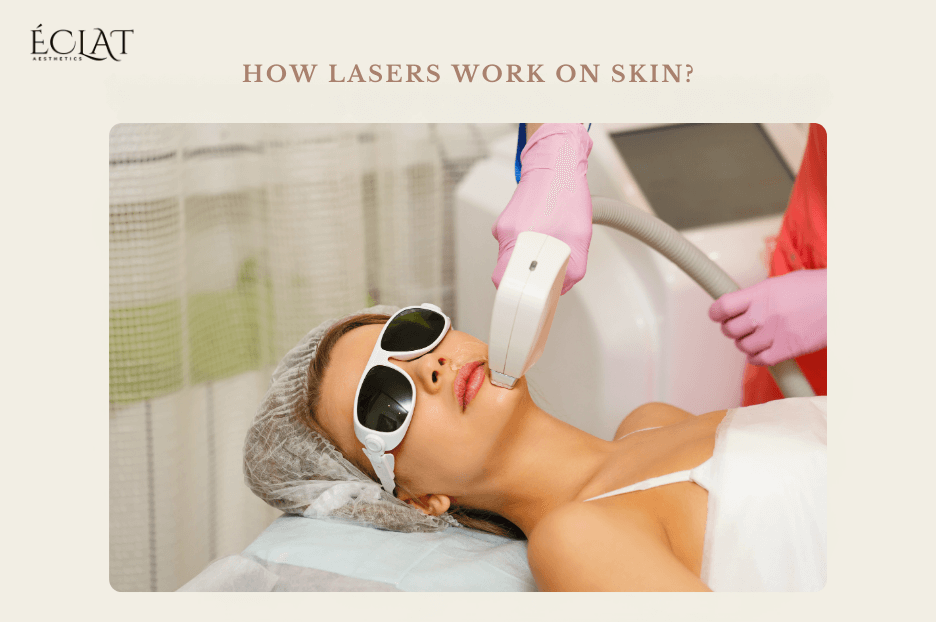 How Lasers Work on Skin