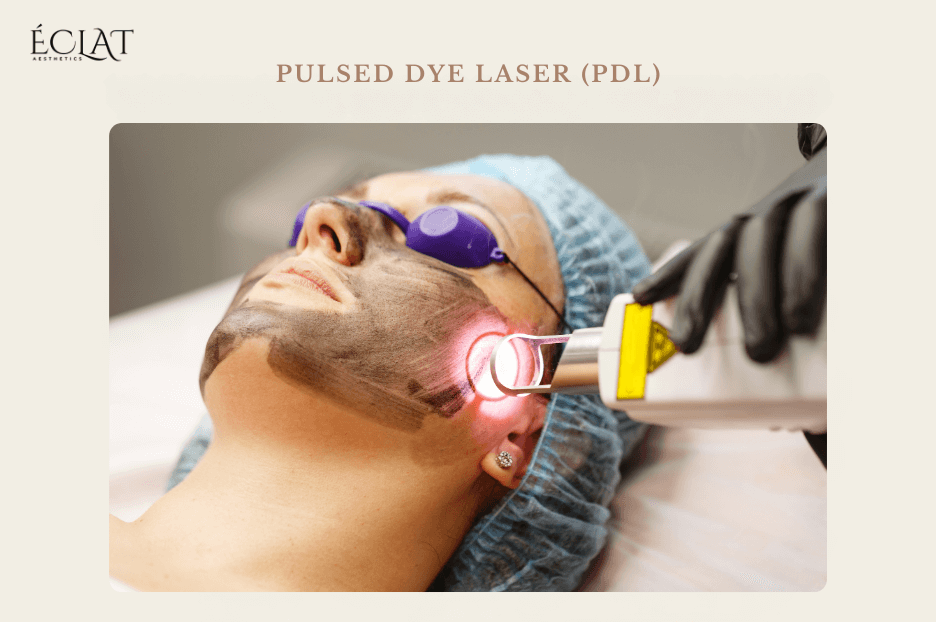 Pulsed Dye Laser