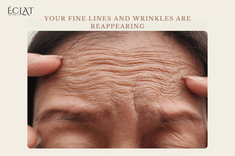 anti-aging touch-up signs anti-aging touch-up signs