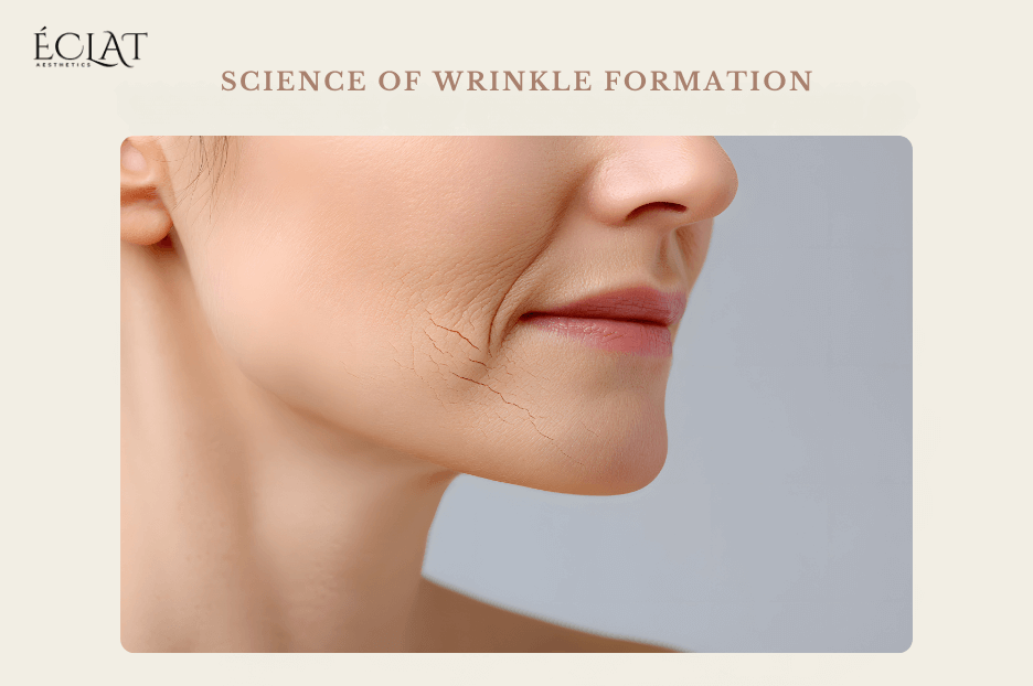 Wrinkle Formation