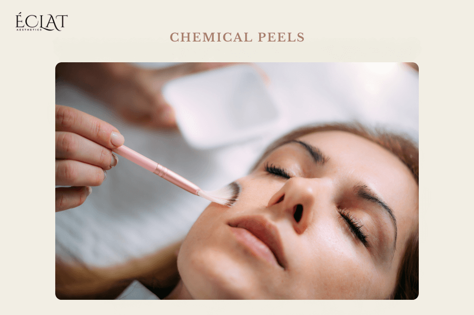 Chemical Peels