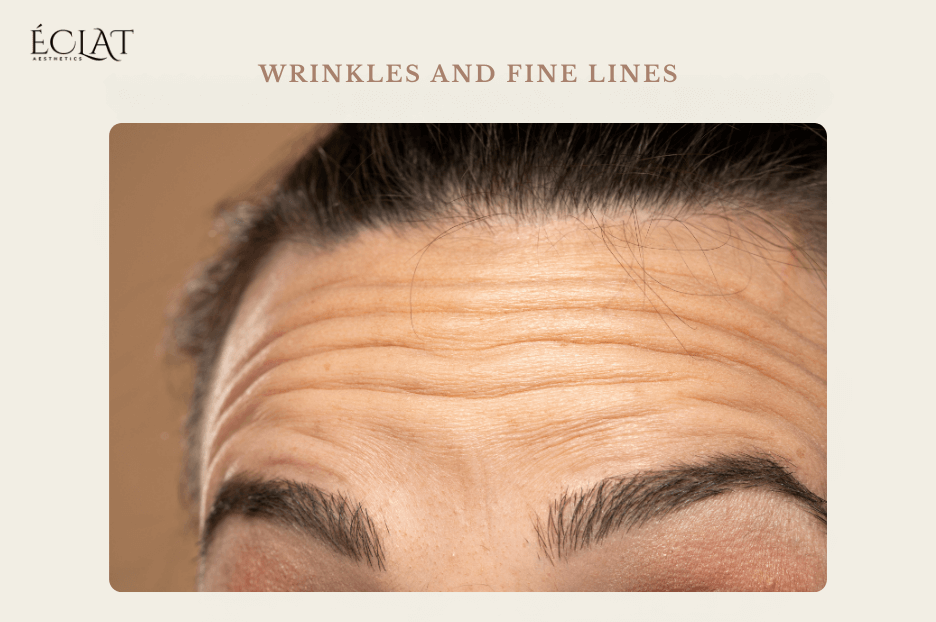 Hormonal Hormonal skin Aging Wrinkles and Fine Lines Aging