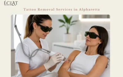 Tattoo Removal Services in Alpharetta: What to Know Before Your First Session