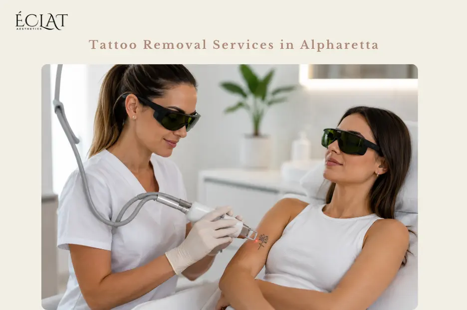 Tattoo Removal Services in Alpharetta: What to Know Before Your First Session