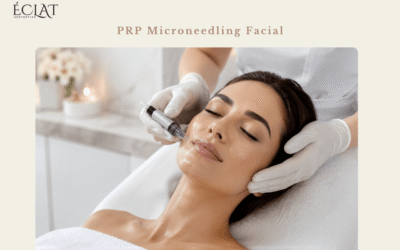 PRP Microneedling Facial: How It Supports Collagen, Texture, and Glow