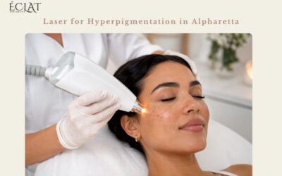Laser for Hyperpigmentation in Alpharetta: Can It Help Dark Spots and Uneven Skin Tone?