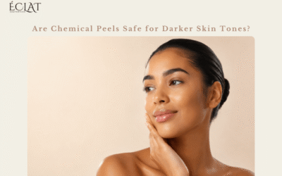 Are Chemical Peels Safe for Darker Skin Tones?
