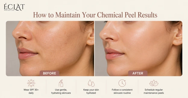 Maintain Your Chemical Peel Results