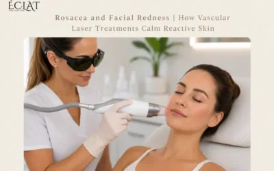 Rosacea and Facial Redness | How Vascular Laser Treatments Calm Reactive Skin