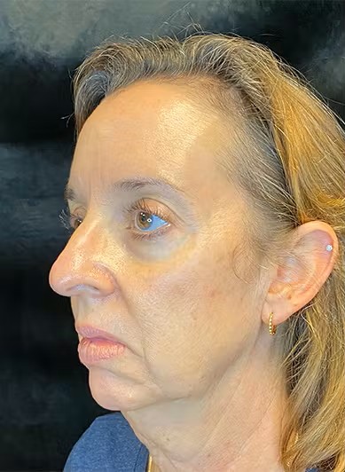 Side profile of a woman's face.