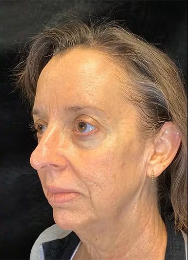 Side view of a woman's face.