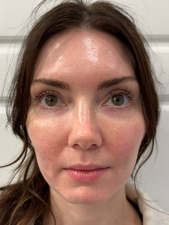 Close-up front view of a woman's face.