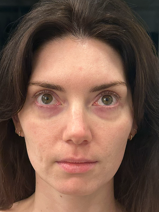front view of a woman's face.