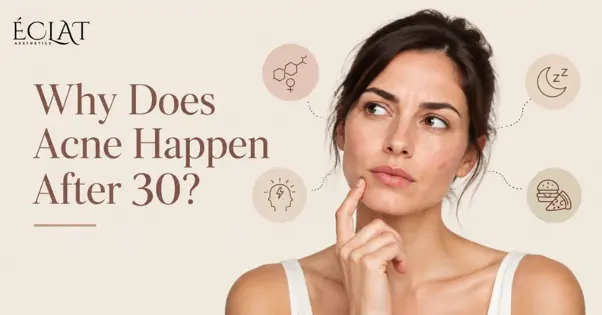 Acne After 30
