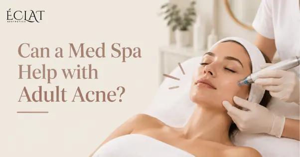 Adult Acne
